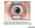 The Eye As A Lens (Part 1)